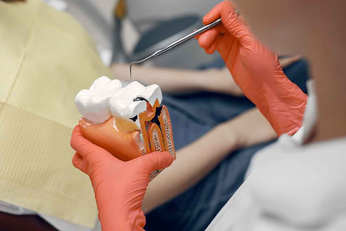 Eyüpsultan 20’lik Diş Çekimi Lisan Klinik