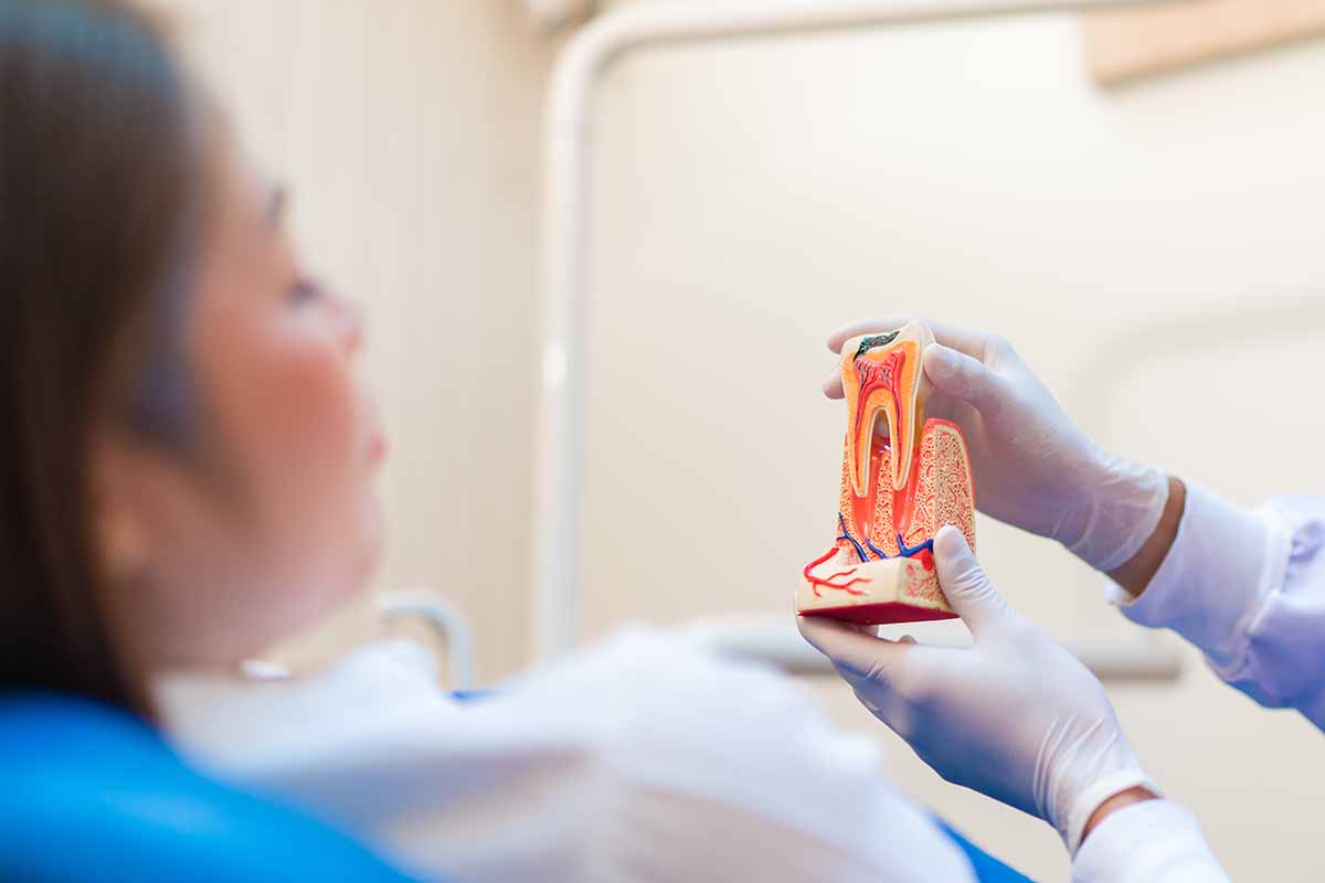 Eyüpsultan Açık Apeksli Dişlerde Kanal Tedavisi - Lisan Klinik