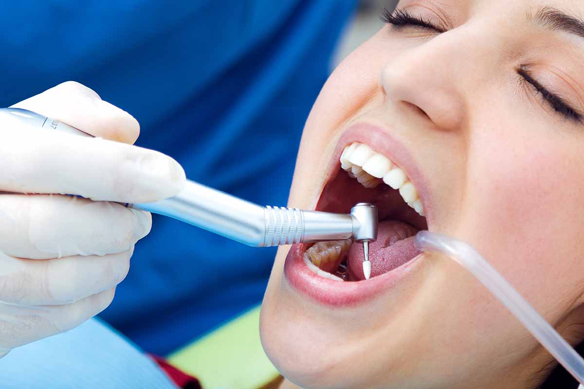 Eyüpsultan Diş Taşı Temizliği - Lisan Klinik