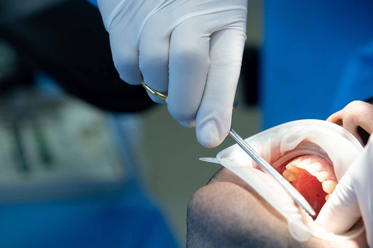 Eyüpsultan Tek Seans Kanal Tedavisi - Lisan Klinik